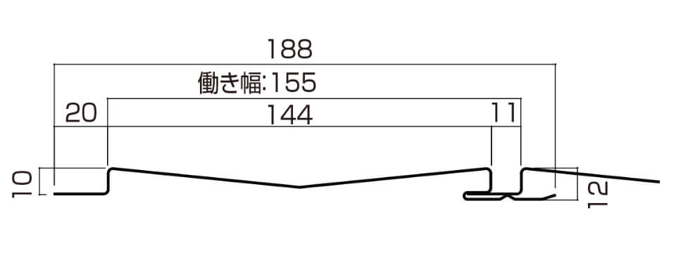 1M型